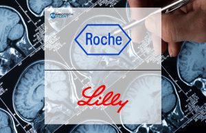 Roche, Lilly Secure U.S. Greenlight for Alzheimer’s Detection Test